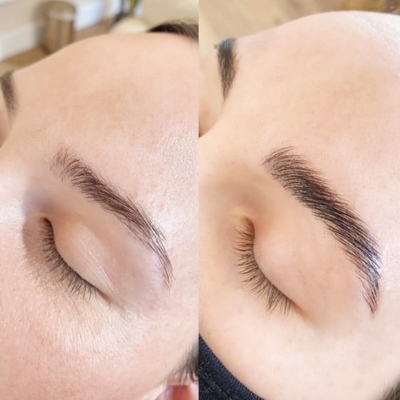 Eyebrow Lamination Sydney